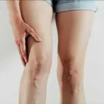 ecco cosa dicono i medici